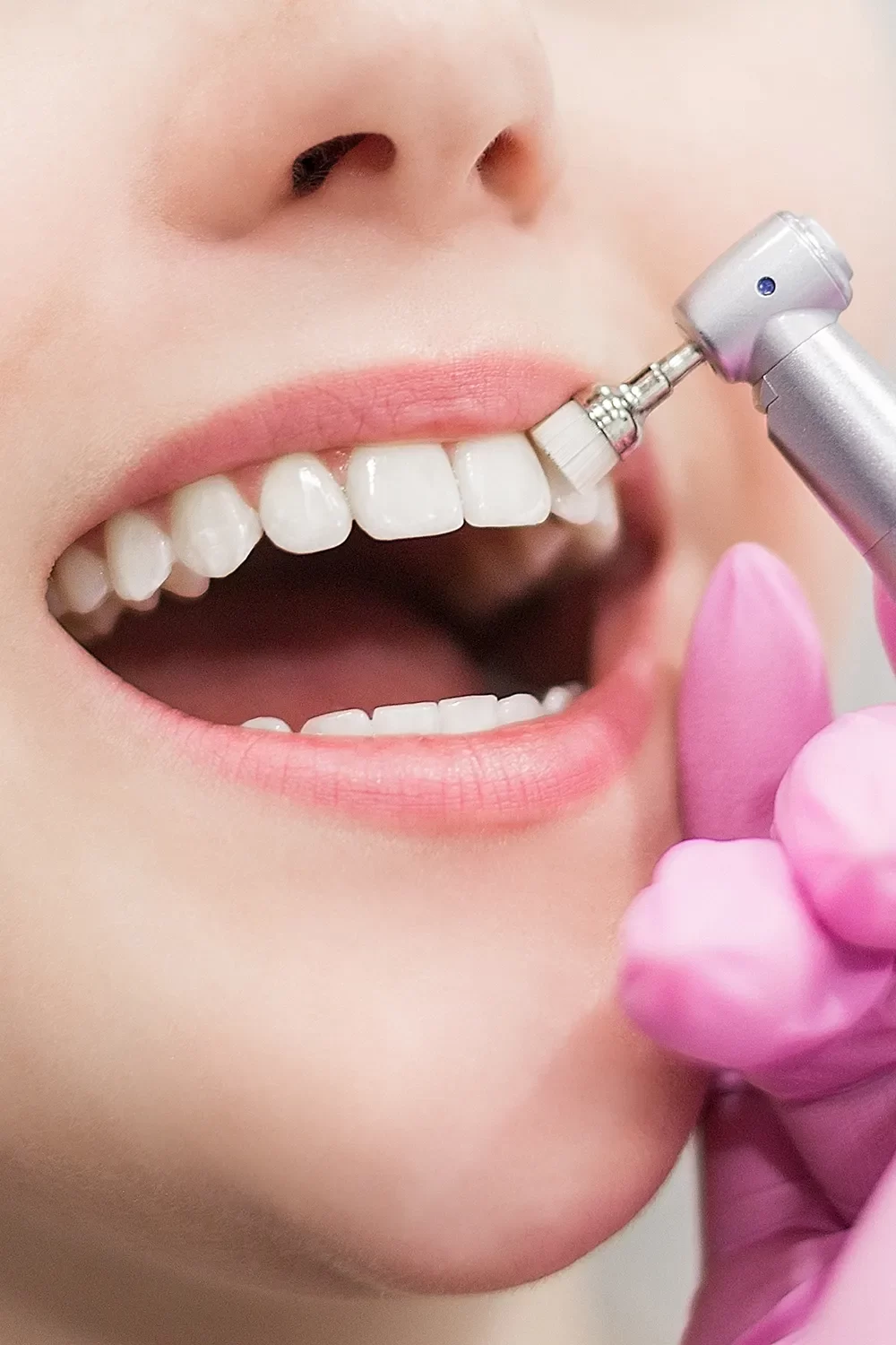 Dental Cleanings