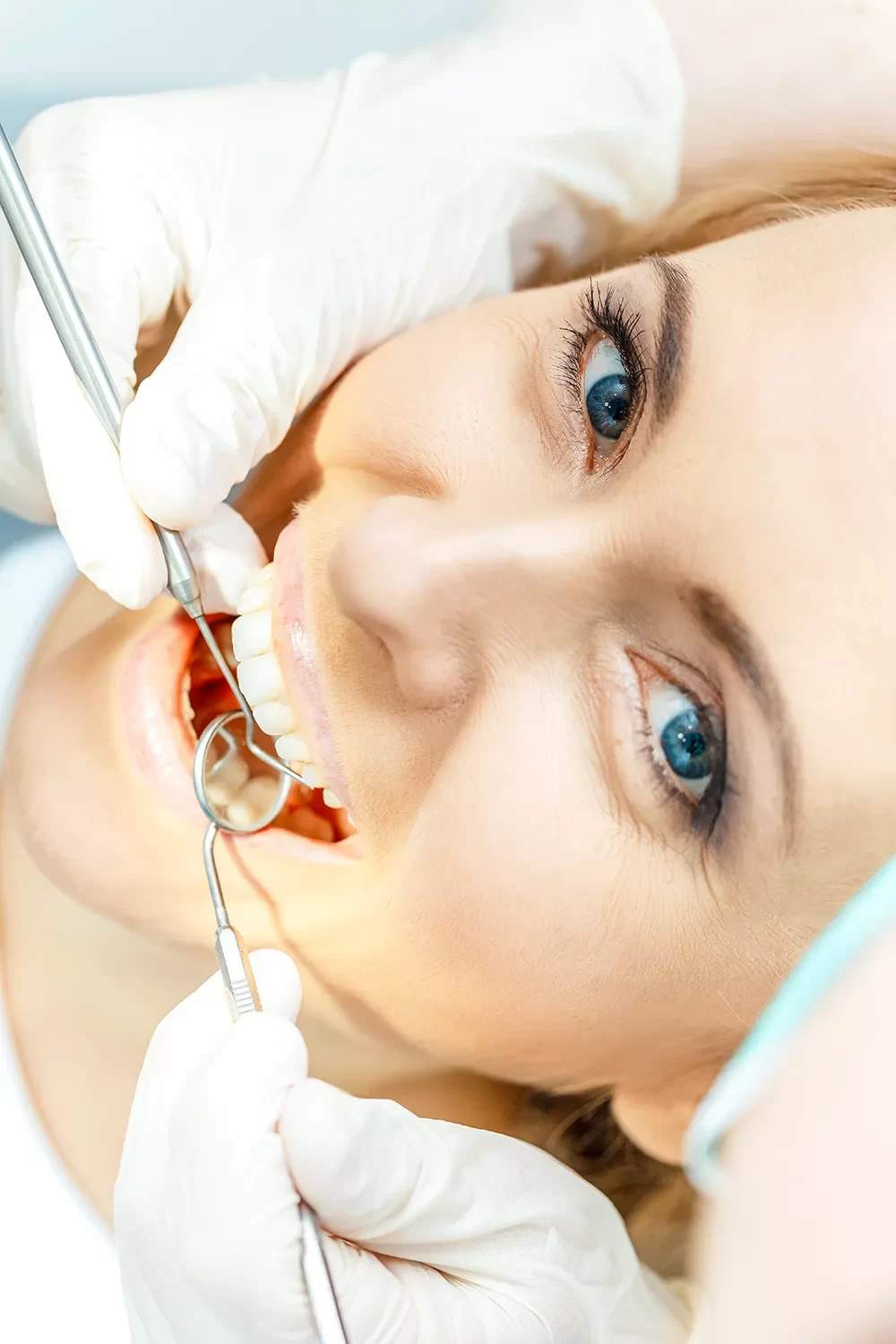 Dental Crowns