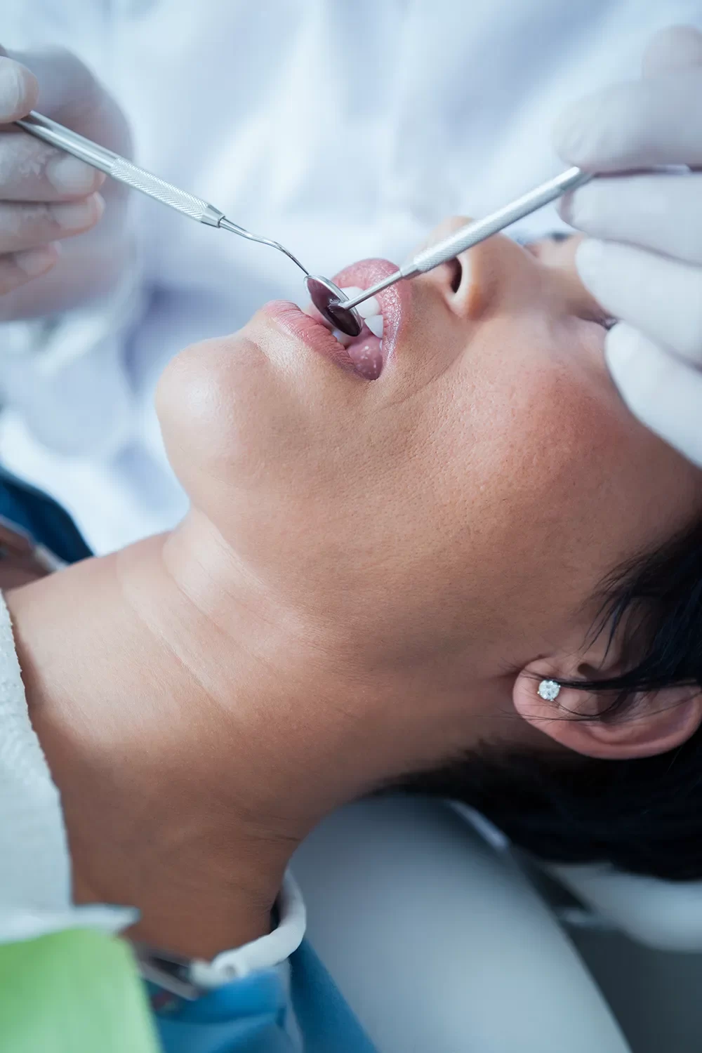 Dental Extraction