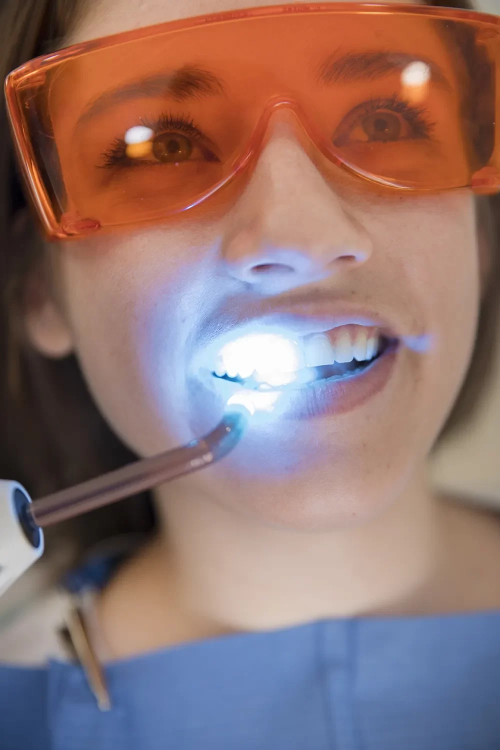 Fluoride Treatments