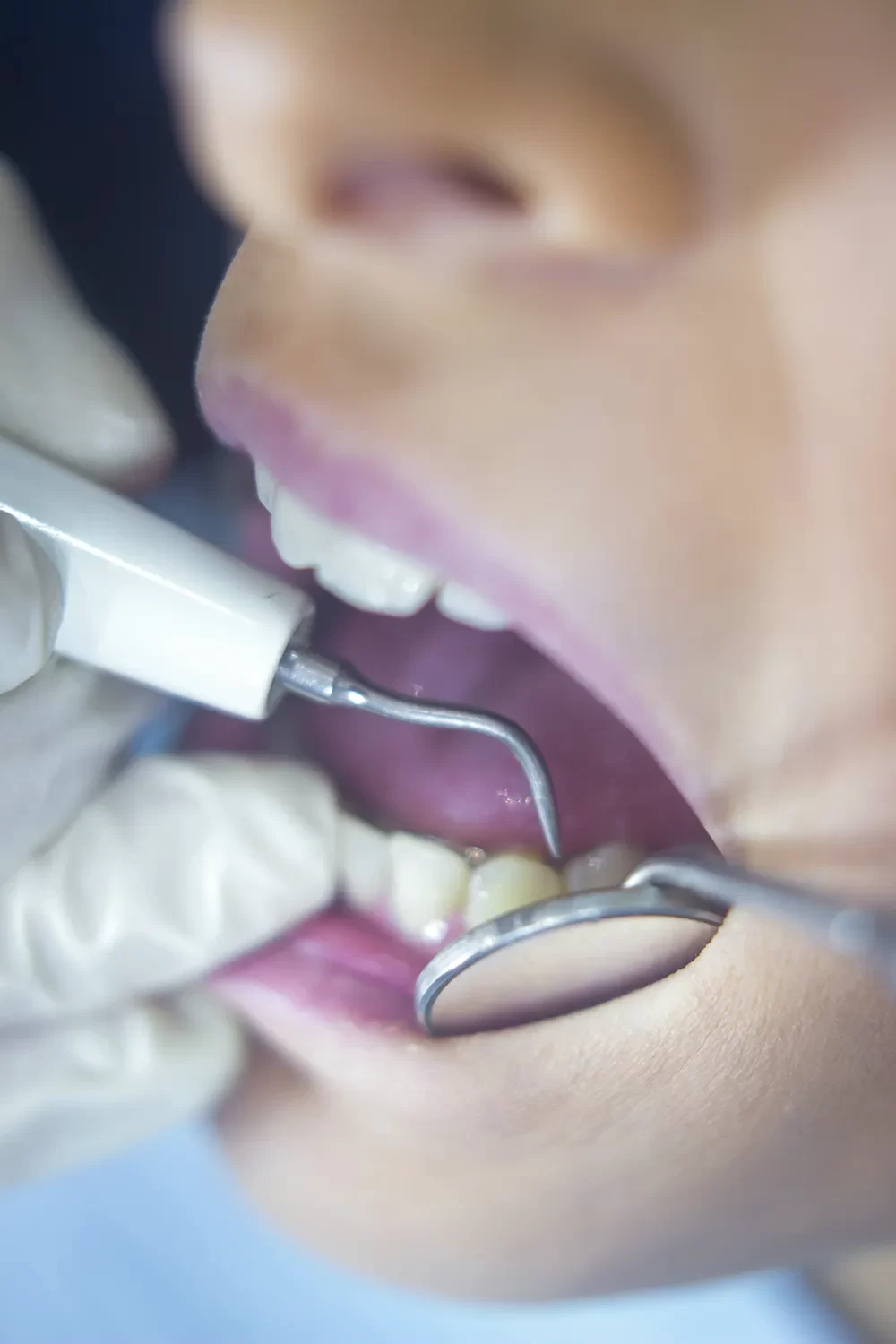 Gum Disease Therapy
