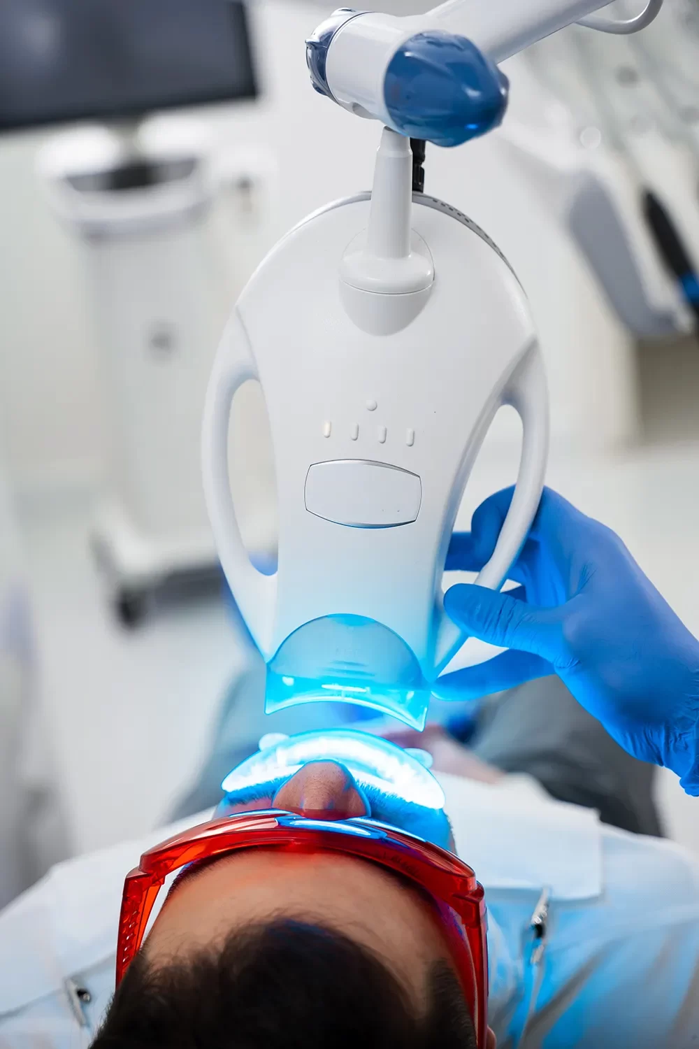 Teeth Whitening